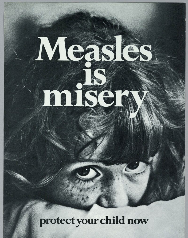 History of Measles Poster