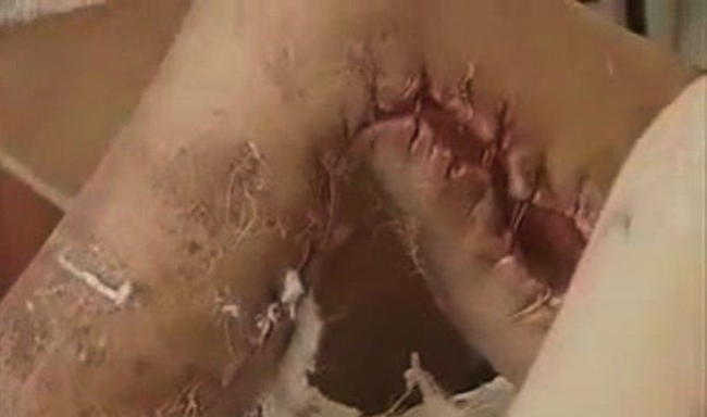 Krokodil Ripped Flesh