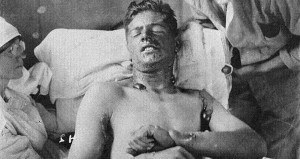 Nazi Research Mustard Gas