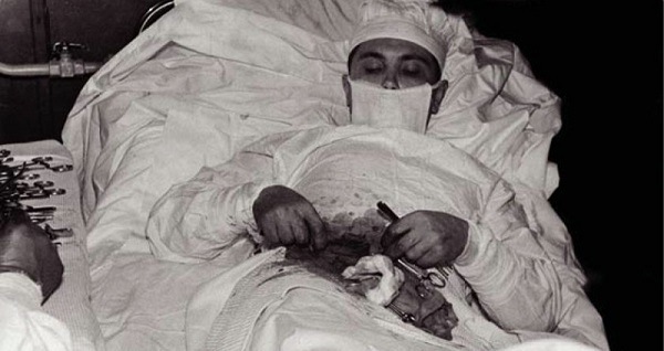 Self Performed Surgery Og