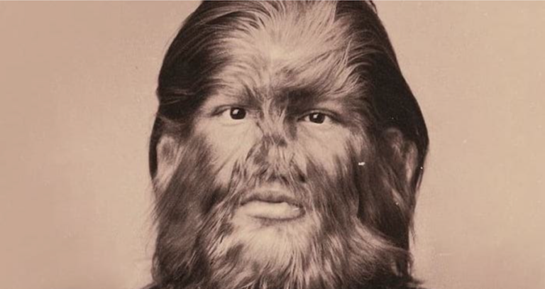 Dog Faced Boy Featured