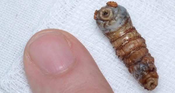 Botfly Finger
