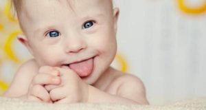 Down Syndrome Baby