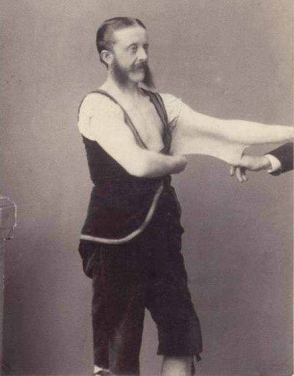 Elastic Man