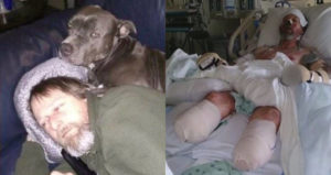 Greg Manteufel Before And After