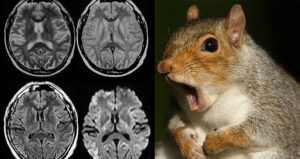 Squirrel And Brain Scan
