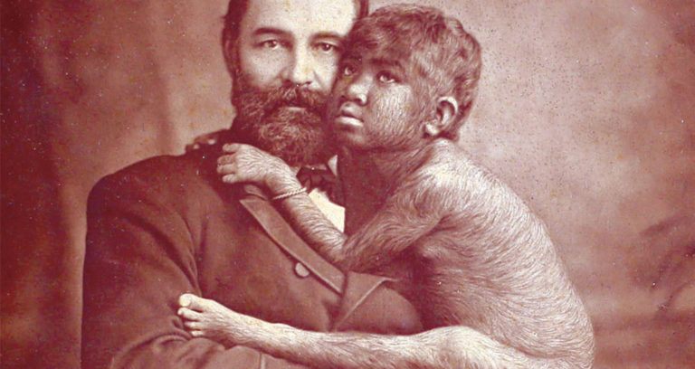 Missing Link Hugs Showman Featured