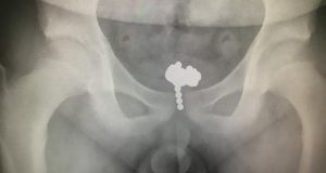 X Ray Magnetic Balls Featured