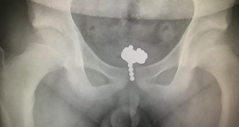 X Ray Magnetic Balls Featured