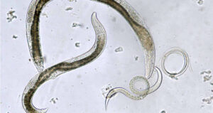 Nematode Worms Swirling Around
