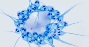 Salminicola Parasite