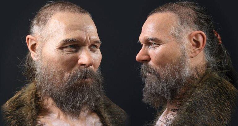 Facial Reconstruction