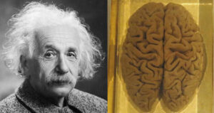 Albert Einstein And Brain