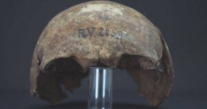 Skull Of Plague Victim