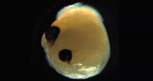 Brain Organoid With Eyes