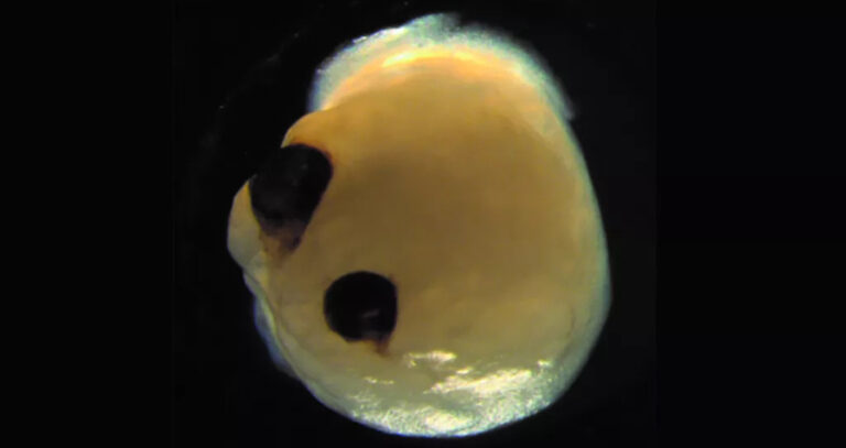 Brain Organoid With Eyes