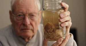 Thomas Harvey Holding Albert Einsteins Brain