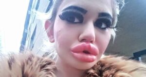 Biggest Lips In The World