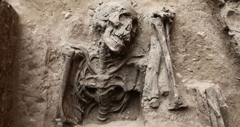 Hospital Real De San Andres Skeletons