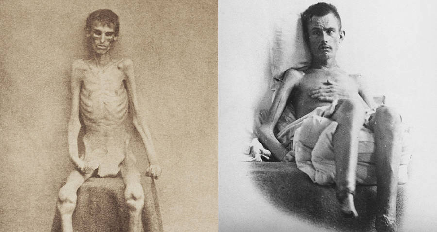 Emaciated Prisoners Featured